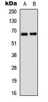 PAK1 Antibody (Internal)