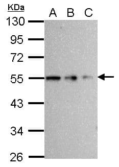 TUBB / Beta Tubulin Antibody