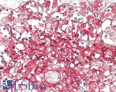 IHC-plus™ Monoclonal Mouse anti-Human THY1 / CD90 Antibody (clone 7E1B11, aa17-132, IHC, IF, WB)