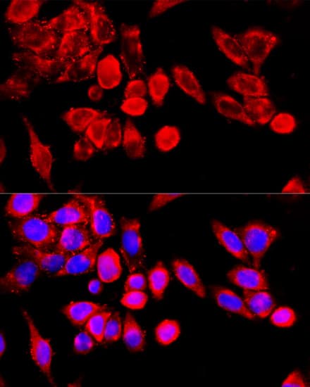 TRPC6 Antibody