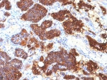 PTH / Parathyroid Hormone Antibody (C-Terminus, clone PTH/1175)