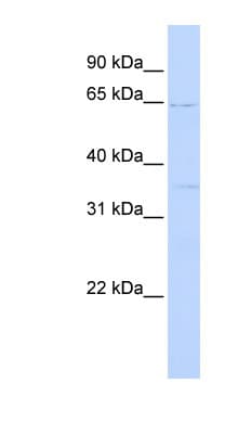 RORA / ROR Alpha Antibody (aa36-85)