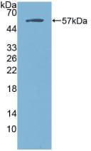 ER Alpha / Estrogen Receptor Antibody (aa248-484)