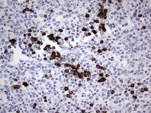 TLK2 Antibody (aa1-296, clone OTI2F9, Carrier-free)