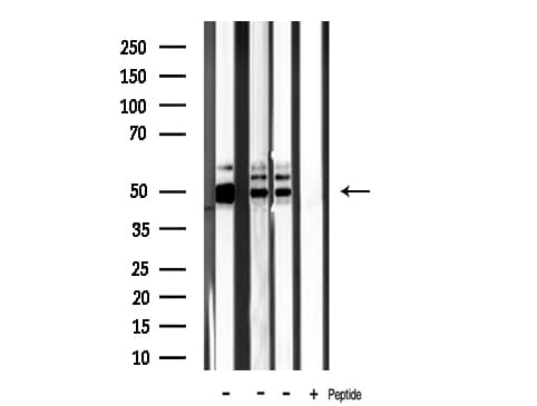 Polyclonal Rabbit anti-Human CKMT2 Antibody (IF, WB)