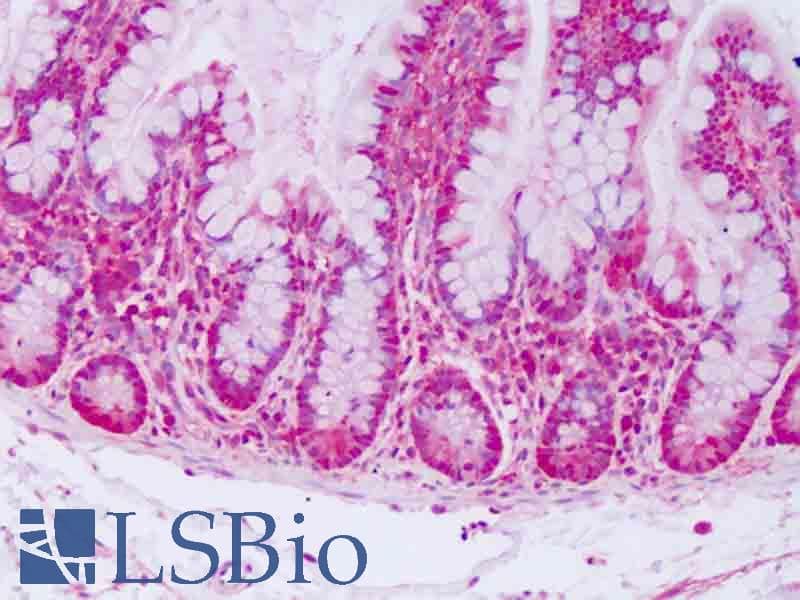 IHC-plus™ SOD1 / Cu-Zn SOD Antibody