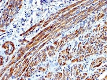 SMMHC / MYH11 Antibody (clone MYH11/923)
