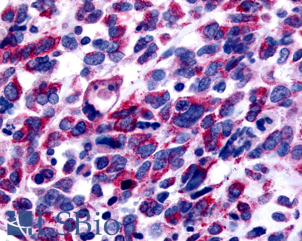 PathPlus™ Polyclonal Rabbit anti-Human GPER1 / GPR30 Antibody (Cytoplasmic Domain, IHC, IF, WB)