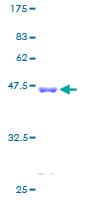 Human PFDN2 Protein (Recombinant GST)