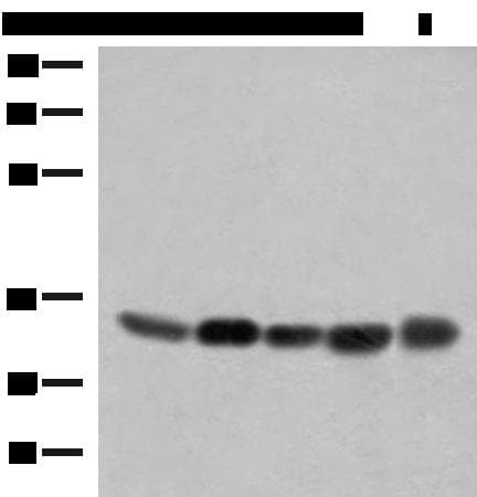 Polyclonal Rabbit anti-Human COPE Antibody (IHC, WB)