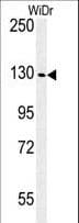 IGF1R / IGF1 Receptor Antibody (aa51-77)