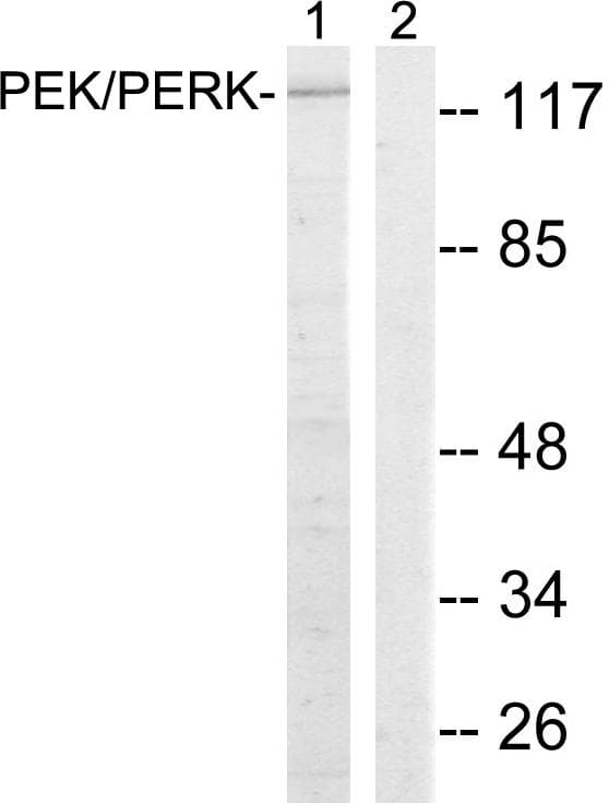 Polyclonal Rabbit anti-Human EIF2AK3 / PERK Antibody (p981, IHC, WB)