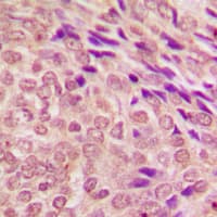 STAT3 Antibody (C-Terminus)