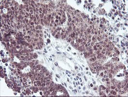 RFXANK Antibody (clone OTI2F12)