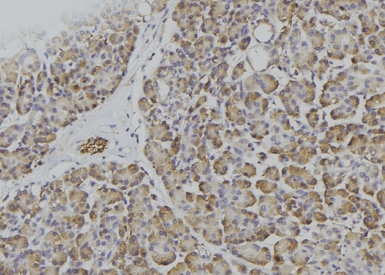 CD45 / LCA Antibody