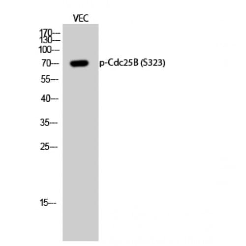 Polyclonal Rabbit anti-Human CDC25B Antibody (260-340 aa, WB)
