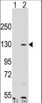 PARP1 Antibody (aa183-214)