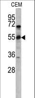 CD36 Antibody (aa213-242)