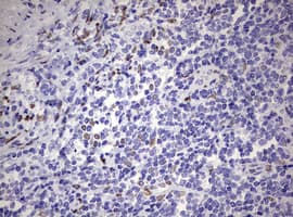 ZEB2 / SIP-1 Antibody (aa1-350, clone OTI1E12)