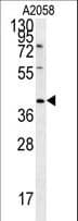 CD99L2 Antibody (aa39-66)