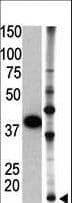 SUMO2 Antibody (aa63-93)
