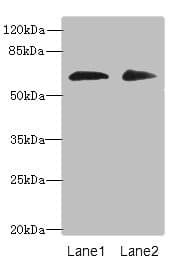 Polyclonal Rabbit anti-Human ZNF529 Antibody (WB)