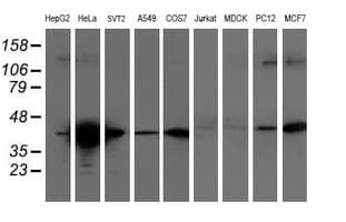 TMOD1 / Tropomodulin 1 Antibody (clone OTI2C2)