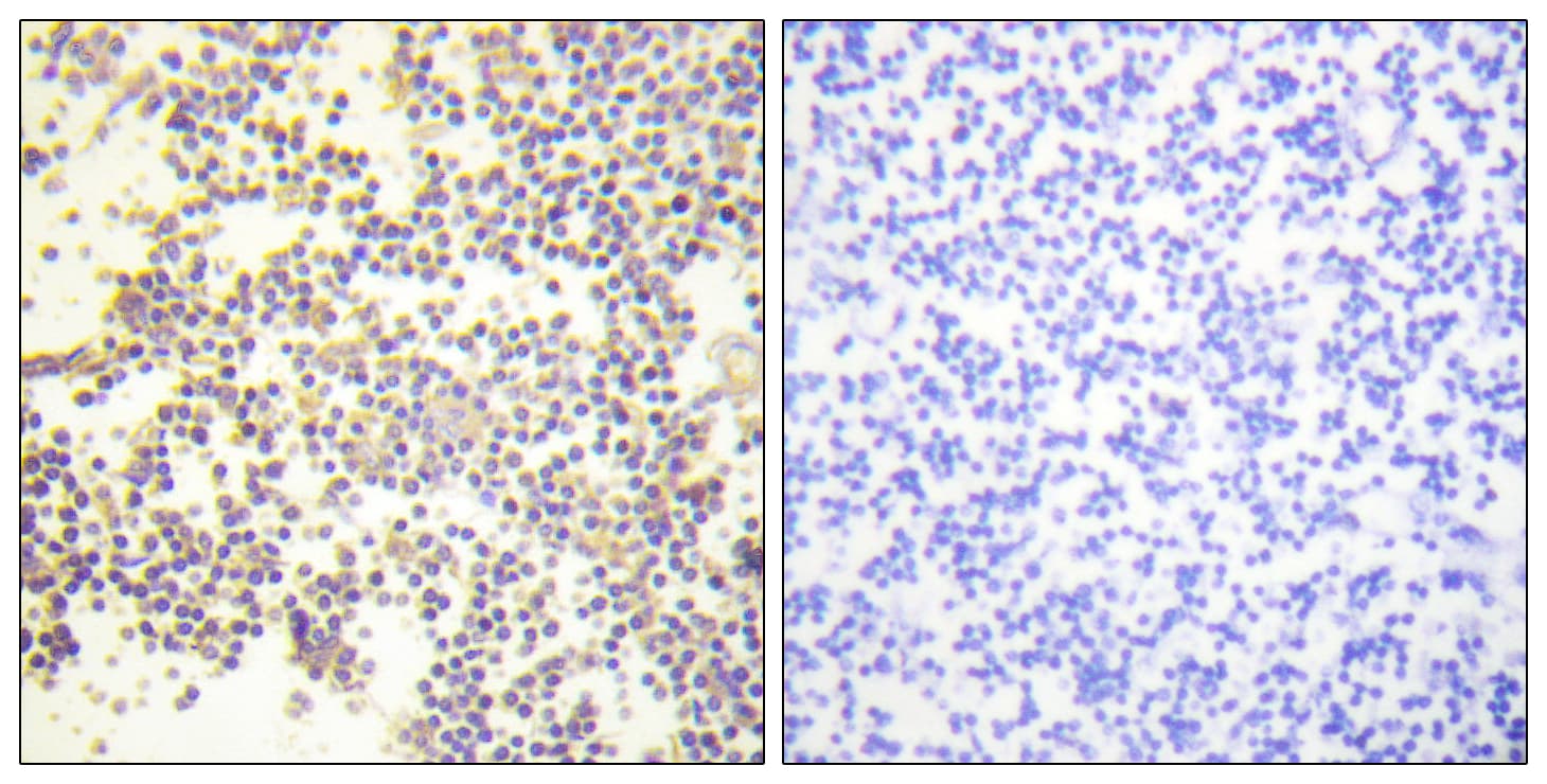NCF1 / p47phox / p47 phox Antibody (phospho-Ser328)
