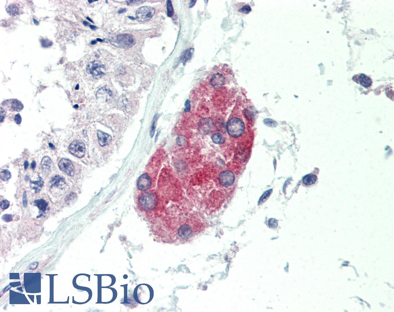 IHC-plus™ Polyclonal Rabbit anti-Human C1QTNF1 / CTRP1 Antibody (IHC, IF, WB)