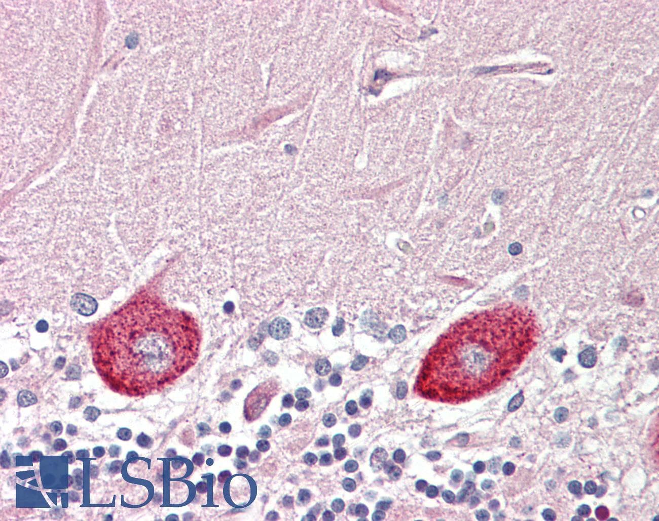 IHC-plus™ Polyclonal Rabbit anti-Human DGKZ Antibody (aa601-650, IHC)