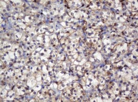 Selenium Binding Protein 1 Antibody (clone OTI3D2)