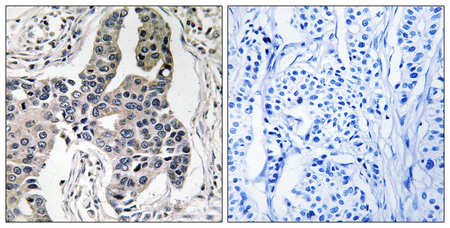 Polyclonal Rabbit anti-Human Vimentin Antibody (phospho-Ser83, IHC, WB)