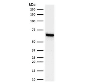 ER Alpha / Estrogen Receptor Antibody (clone NR3Ga-2)