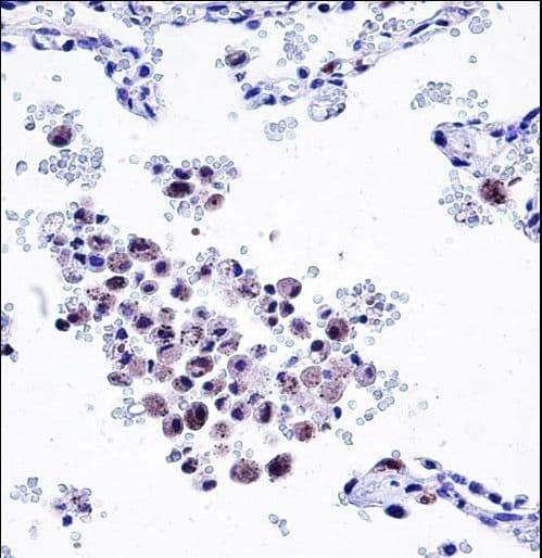 Polyclonal Rabbit anti-Human ARHGDIB / D4 GDI Antibody (aa160-188, IHC, WB)