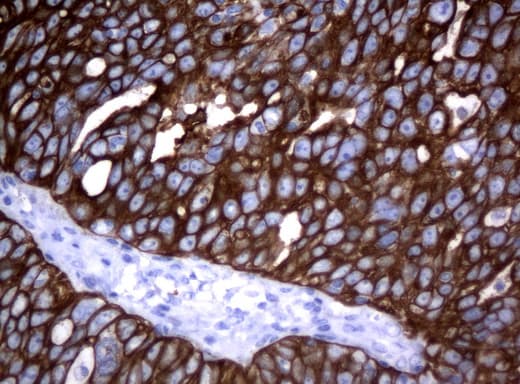 Monoclonal Mouse anti-Human KRT18 / CK18 / Cytokeratin 18 Antibody (clone UMAB50, Carrier-free, aa69-372, IHC, IF, WB)