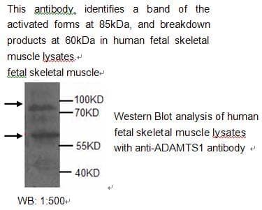 Polyclonal Rabbit anti-Human ADAMTS1 Antibody (WB)