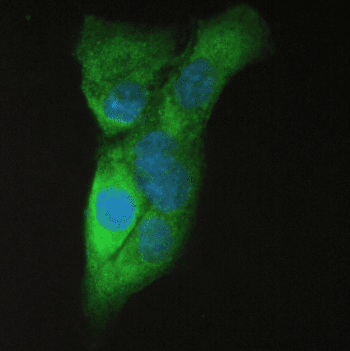 Beta Amyloid Antibody (aa672-702)