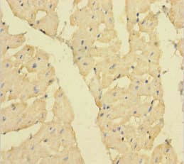 Polyclonal Rabbit anti-Human MBNL1 / MBNL Antibody (WB)