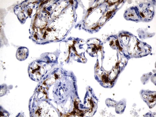 F13A1 / Factor XIIIa Antibody (clone UMAB243)