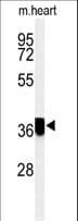 Polyclonal Rabbit anti-Human CCDC42 Antibody (aa121-150, IHC, WB)