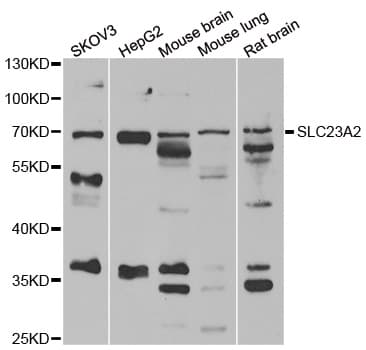 Polyclonal Rabbit anti-Human SLC23A2 / SVCT2 Antibody (WB)