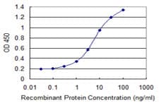 AIPL1 Antibody (clone 1E1)