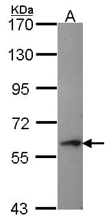 Polyclonal Rabbit anti-Human PRF1 / Perforin Antibody (aa9-214, WB)