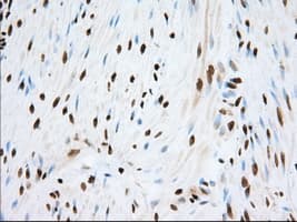 ERIC-1 / TACC3 Antibody (clone OTI6F1, Carrier-free)
