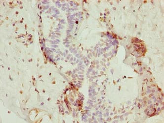 NOP10 Antibody