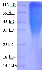 Human CRFR1 / CRHR1 Protein (Recombinant His)