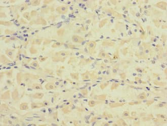 FCRL2 / IRTA4 Antibody