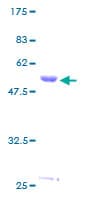 Human HLA-DMA Protein (Recombinant GST)