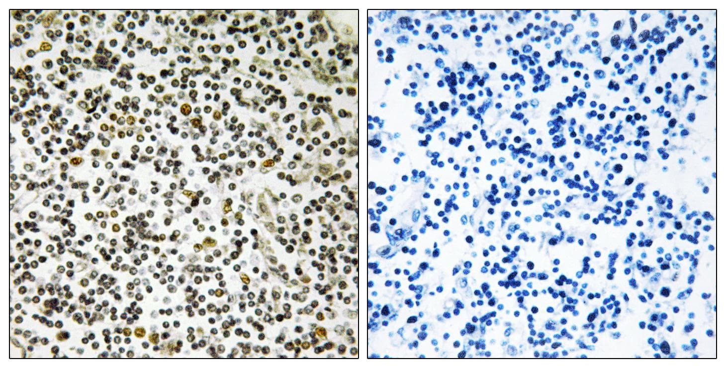 Polyclonal Rabbit anti-Human CEP152 Antibody (IHC)