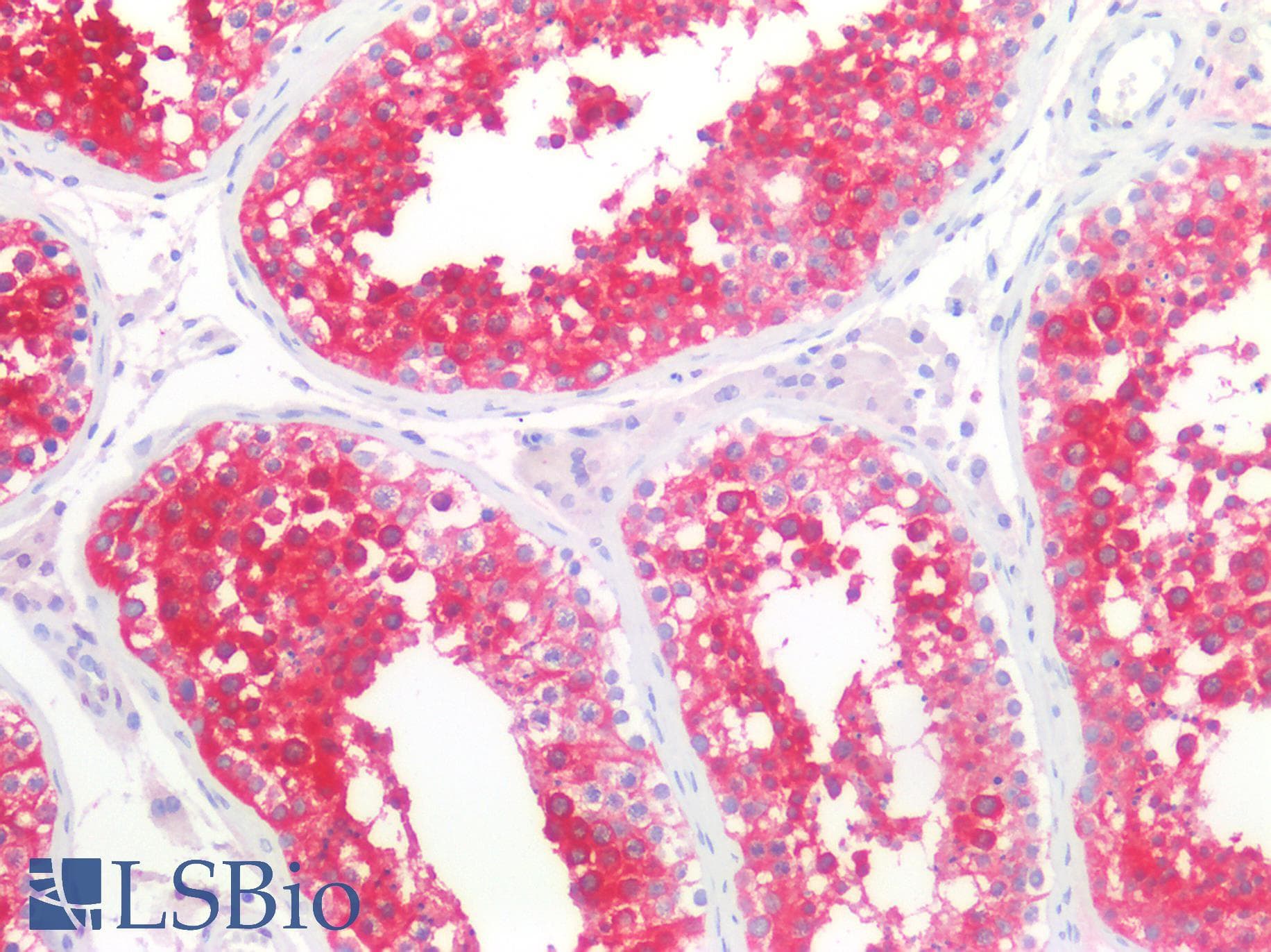 PathPlus™ STMN1 / Stathmin / LAG Antibody